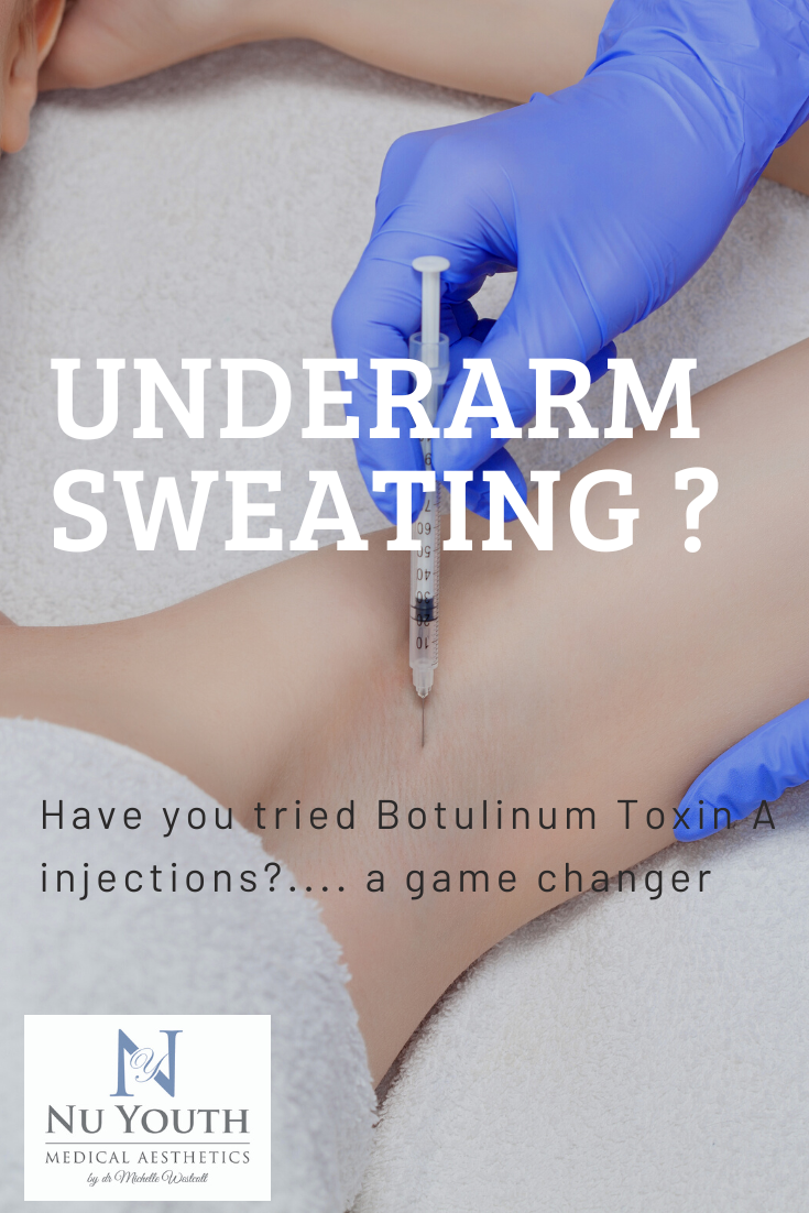 excessive sweating botox 